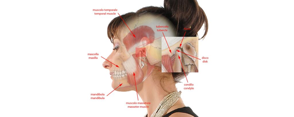 malposizionamento della mandibola e malessere muscolare
